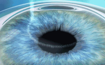 微信图片_20201112083517.gif 微信图片_20201112083517.gif